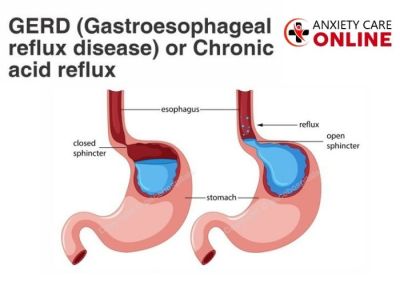 Gastroesophageal Reflux Disease is an unpleasant condition that occurs as a heartburn, swallowing difficulty, regurgitation and other physical complications. This condition occurs when our stomach acid continuously flows back into the tube connecting the mouth and stomach. GERD is a widely spread health condition that affects approximately one out of every five people in the western world.
People with severe asthma symptoms are more likely to experience this disease. Asthma flare-ups can cause the esophageal sphincter to relax and let stomach contents flow back. Certain asthma medicines, both OTC and prescription, can worsen reflux symptoms.
At the same time, acid reflux can worsen asthma symptoms by irritating the lungs and airways. This unnecessary irritation can trigger an allergic reaction and make your airways more sensitive to environmental conditions like cold air or smoke.

Visit : https://anxietycare.online/gerd-gastroesophageal-reflux/